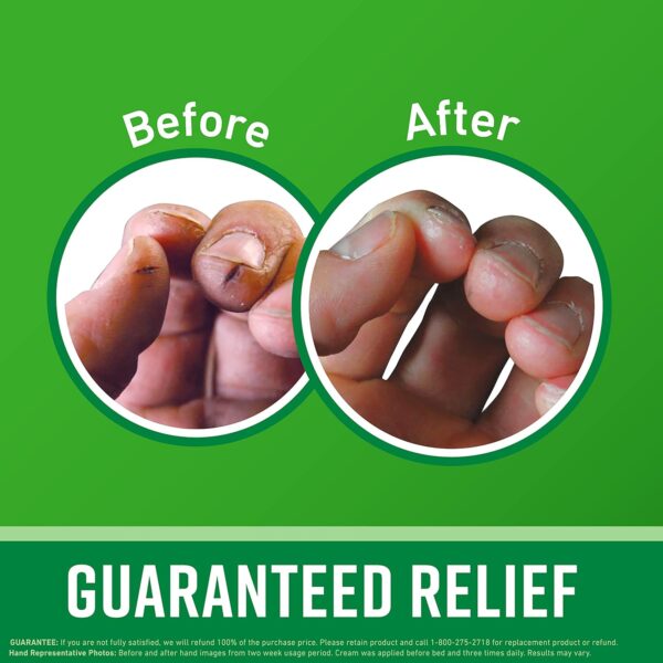 O'Keeffe's Working Hands Hand Cream; For Extremely Dry; Cracked Hands